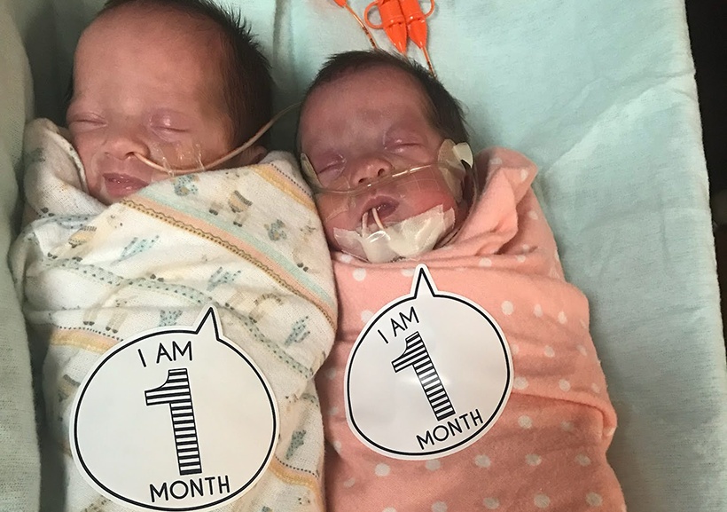 Emma and Lilly Bush are miracle children.