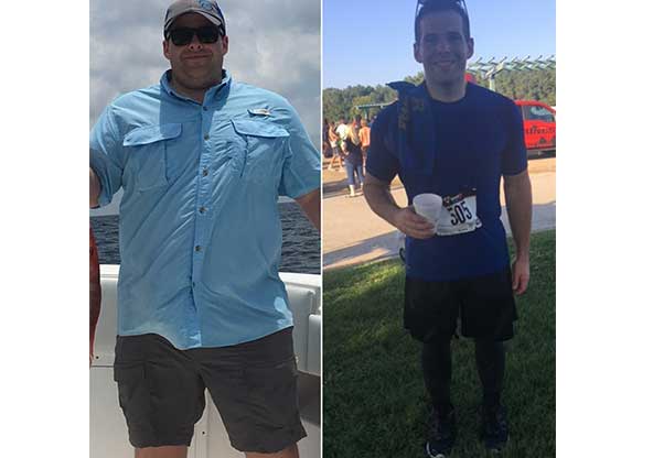 Dakota's before and after weight loss surgery with Dr. McDermott